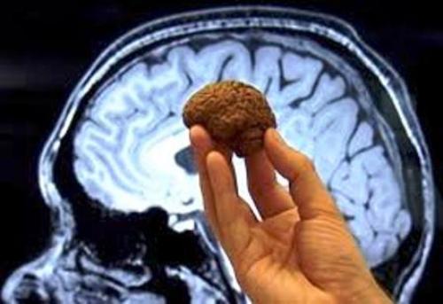 Étude confirme effets du chocolat sur le cerveau humain