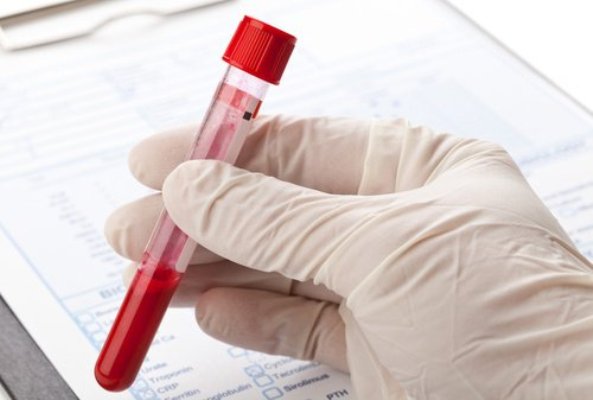 Un test sanguíneo podría predecir la esperanza de vida