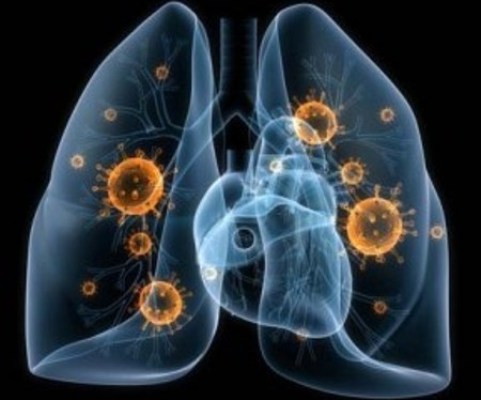 Consulta integral en Camagüey contra cáncer pulmonar reporta buenos resultados