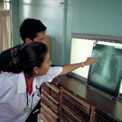 Refuerzan en Camagüey acciones sanitarias para prevenir la tuberculosis