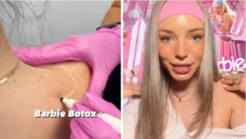 Alerte sur le danger de l’opération esthétique Barbie Botox
