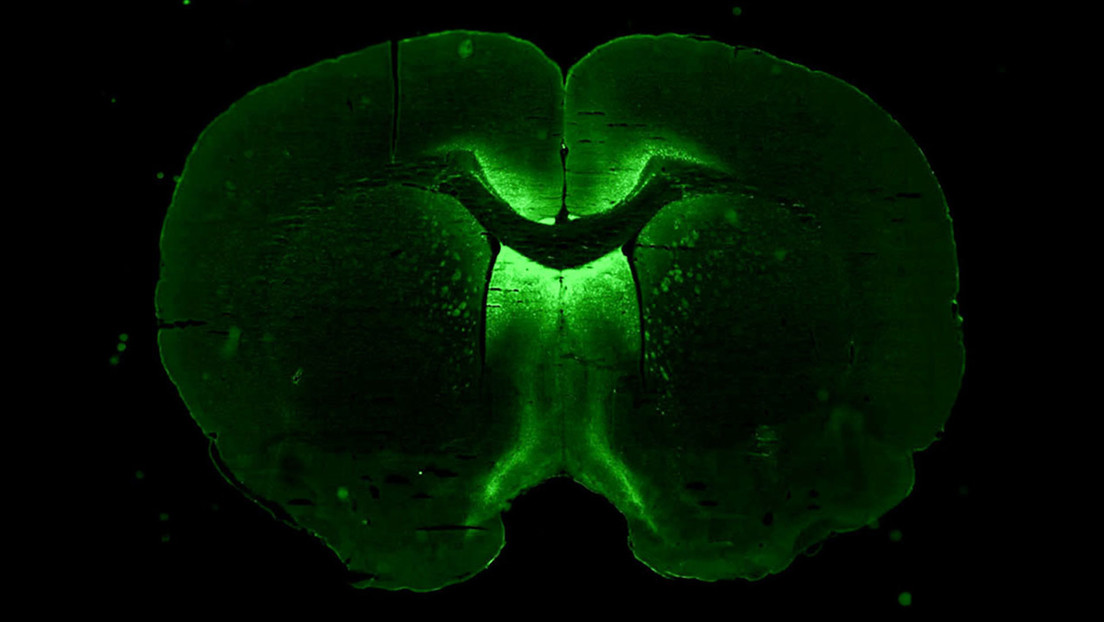 3D human mini-brains to be grown on the International Space Station