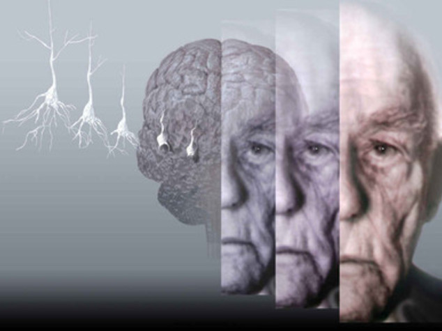 Artificial intelligence can help detect Alzheimer's risk factors