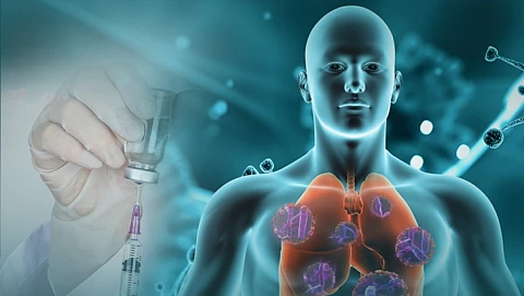 Trabajan en Nuevitas para prevenir la tuberculosis