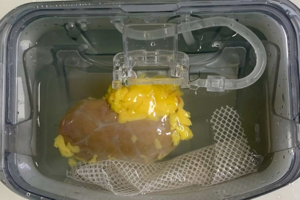 Científicos crean un riñón universal compatible con cualquier paciente