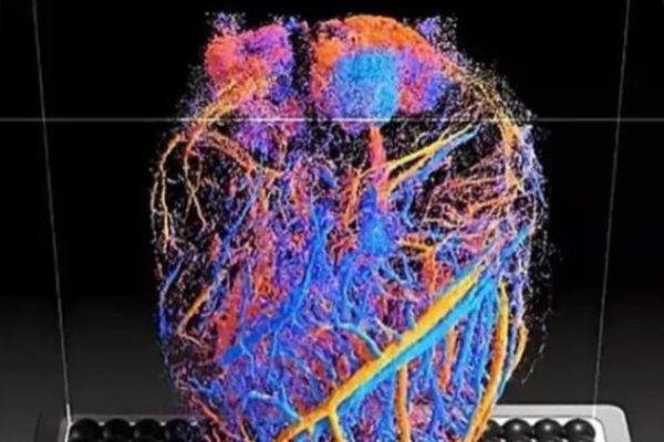 Eco 4D muestra el flujo sanguíneo en órganos