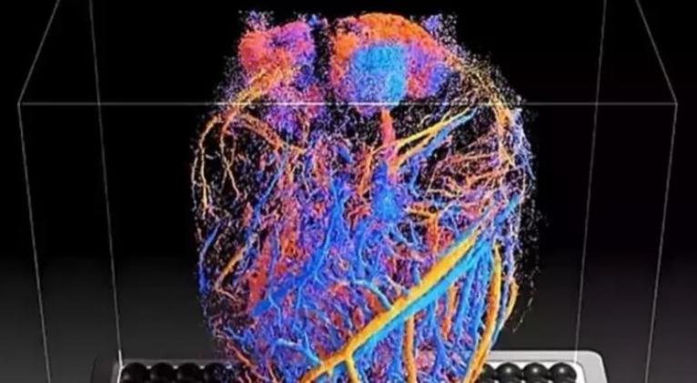 Eco 4D muestra el flujo sanguíneo en órganos