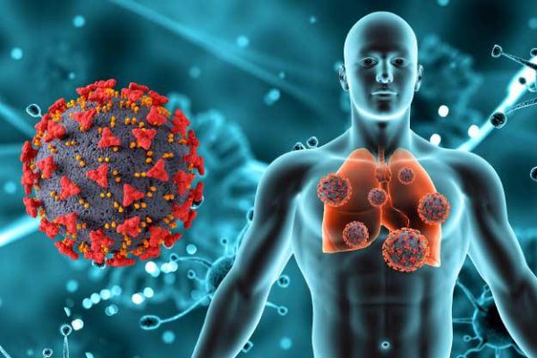 Alertas ante la neumonía