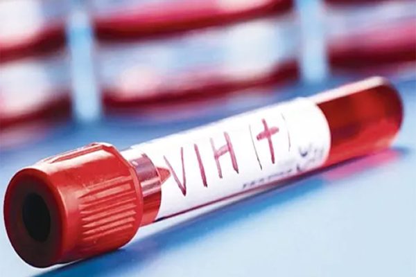 Diagnóstico temprano podría reducir muertes por VIH en América Latina