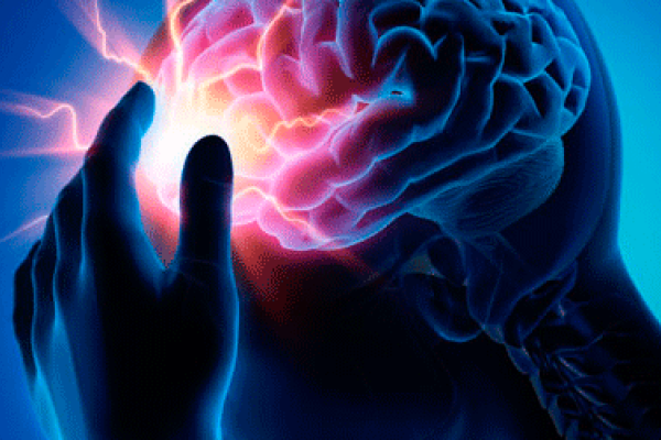 Investigan causas de la morbimortalidad por enfermedad cerebrovascular