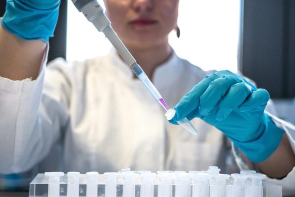 Desarrollan prometedora terapia para la enfermedad de Parkinson