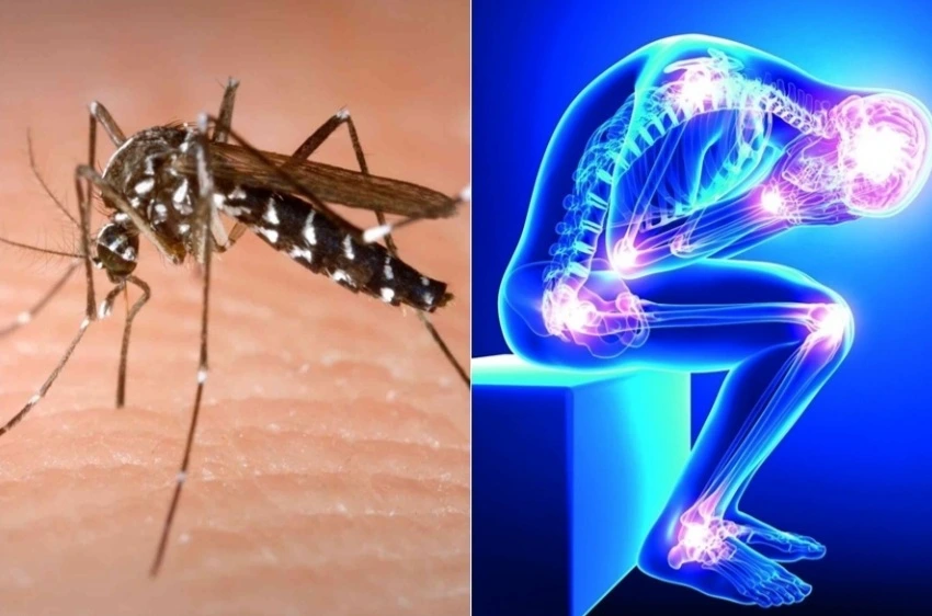 Ofrecen en Nuevitas atención especializada a pacientes con secuelas del chikungunya