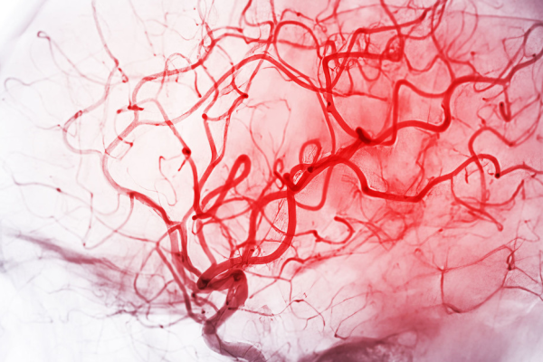 Hallan una posible llave vascular para la demencia