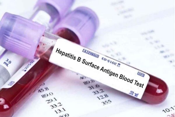 Disminuyen infecciones de hepatitis B en el mundo