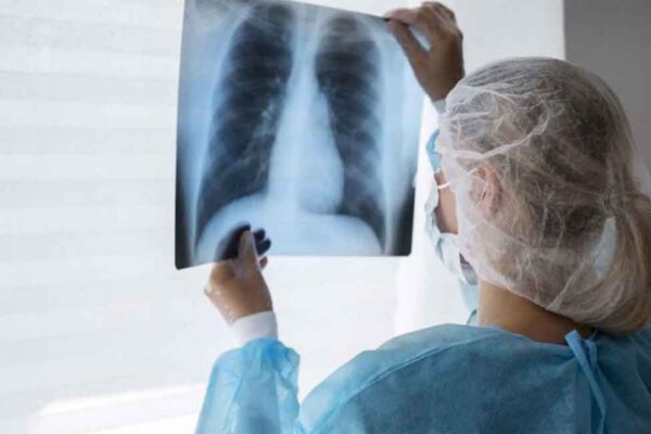 En marcha nueva estrategia mundial contra la tuberculosis