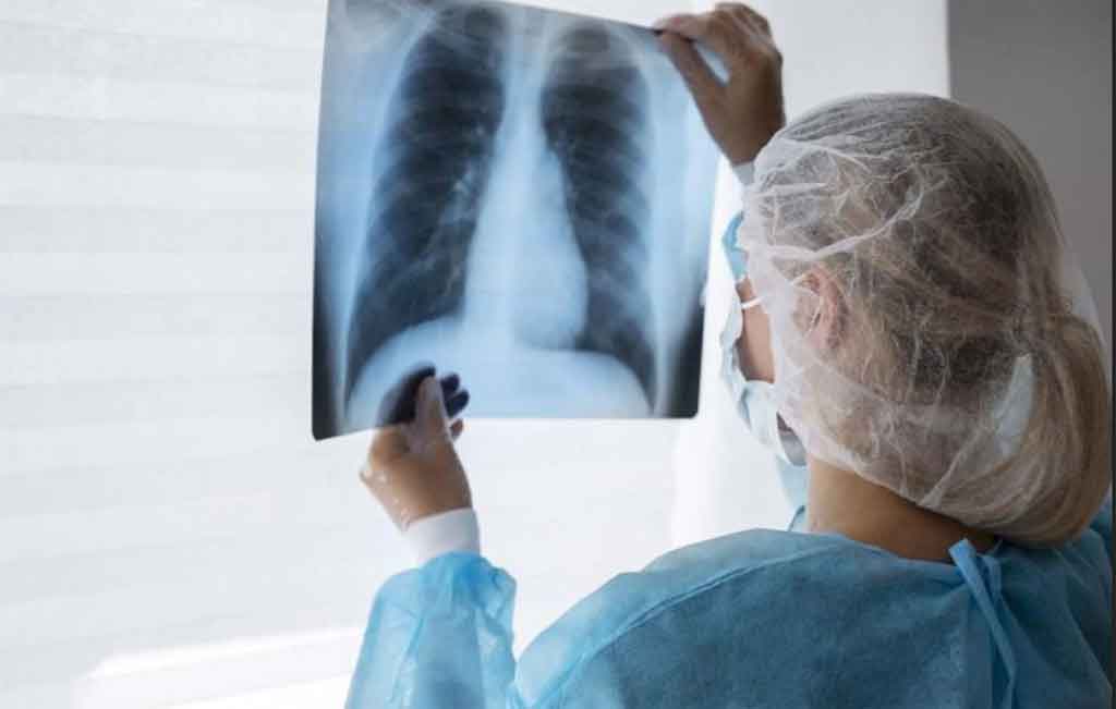 En marcha nueva estrategia mundial contra la tuberculosis